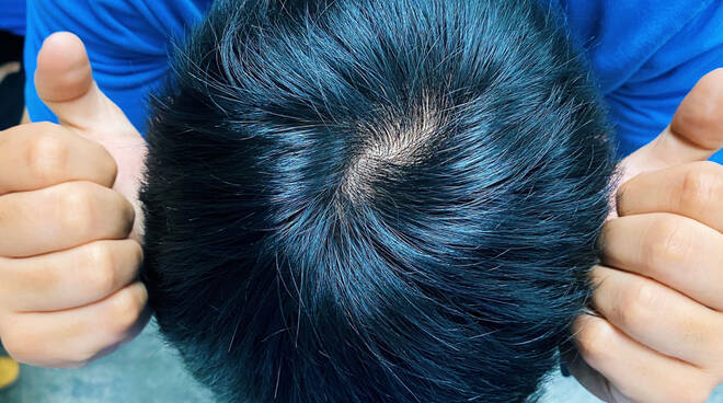 7 consigli per infoltire i capelli senza interventi chirurgici (per gli  uomini) - Luccaindiretta