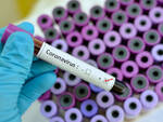 coronavirus test tampone 