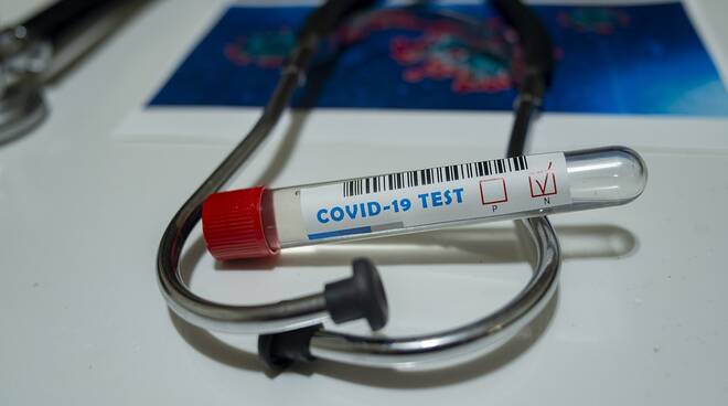 test sierologici coronavirus