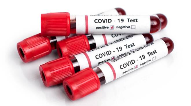 covid, coronavirus